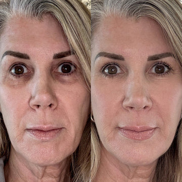 Glowstry™ Under-Eye Red Light Therapy Results2
