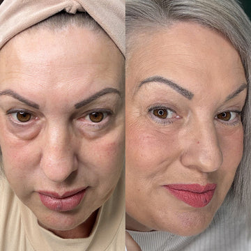 Glowstry™ Under-Eye Red Light Therapy Results3