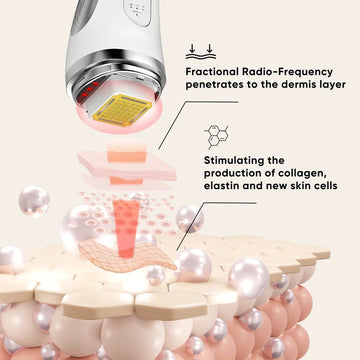RF produced noticeable clinical results, with high satisfaction and corresponding facial skin improvement.