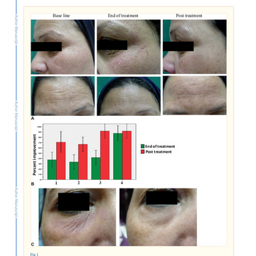 Representative photographs of periorbital and forehead areas at baseline, end of treatment, and 3 months posttreatment