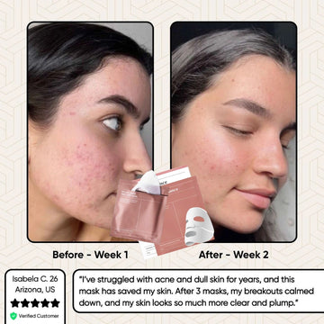 Glowstry Bio-Collagen Mask before-after3