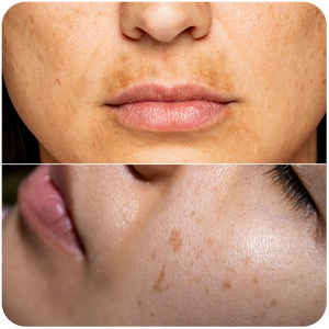 Dull, Lackluster Skin