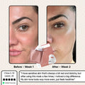 Glowstry Bio-Collagen Mask before after