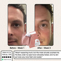 Glowstry Bio-Collagen Mask before after 3