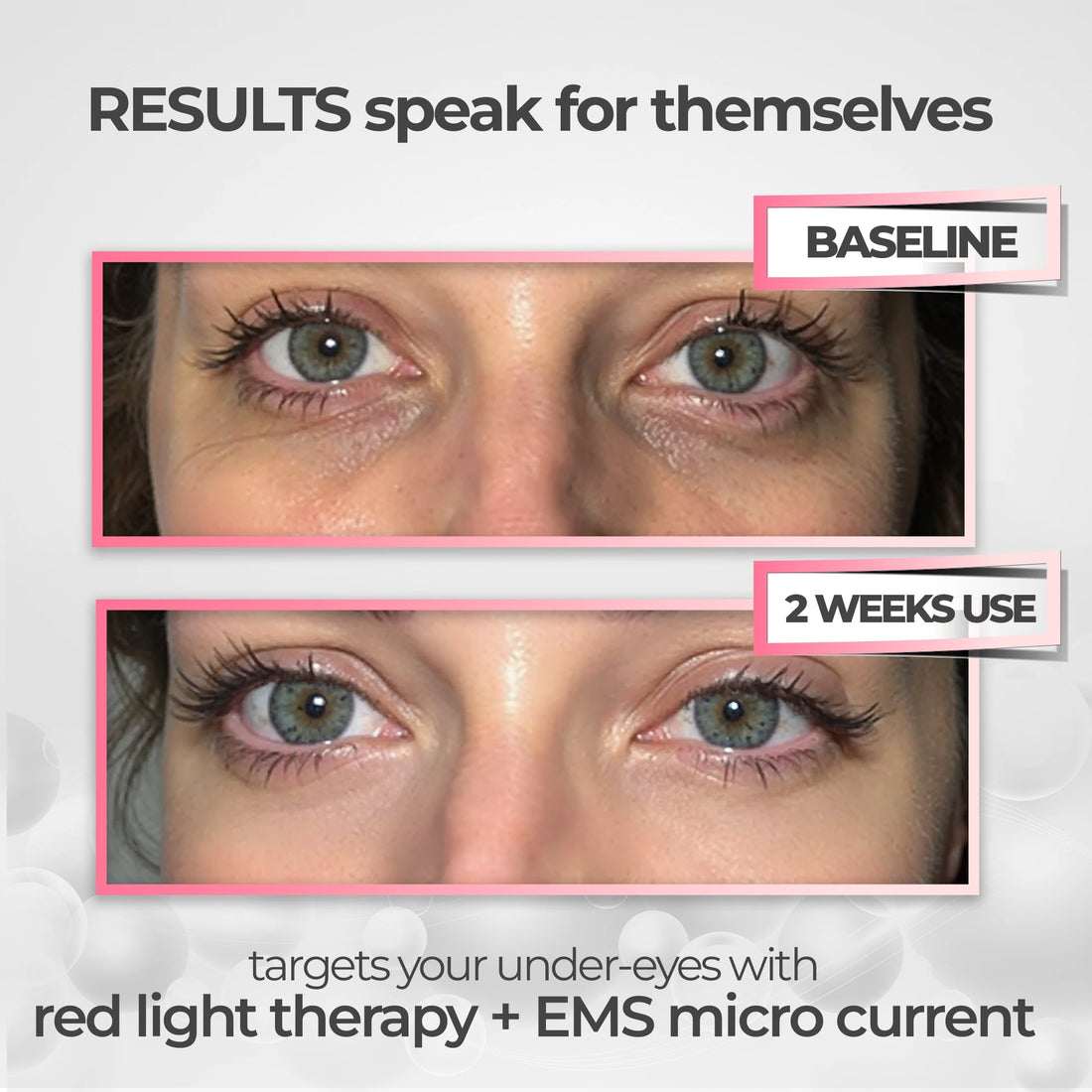 Glowstry™ Under-Eye Red Light Therapy