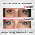 Glowstry™ Under-Eye Red Light Therapy Results