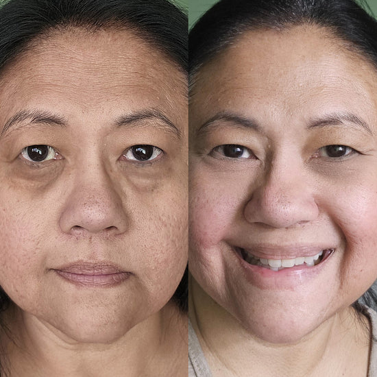 Glowstry™ Under-Eye Red Light Therapy Results1