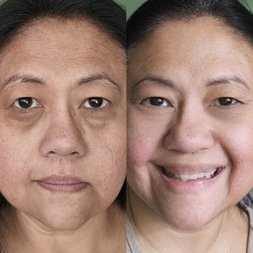Glowstry™ Under-Eye Red Light Therapy Results1