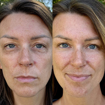 Glowstry™ Under-Eye Red Light Therapy Results4