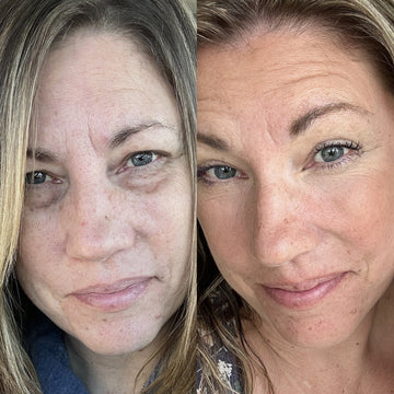 Glowstry™ Under-Eye Red Light Therapy Results6