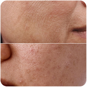 Uneven Texture of Scin