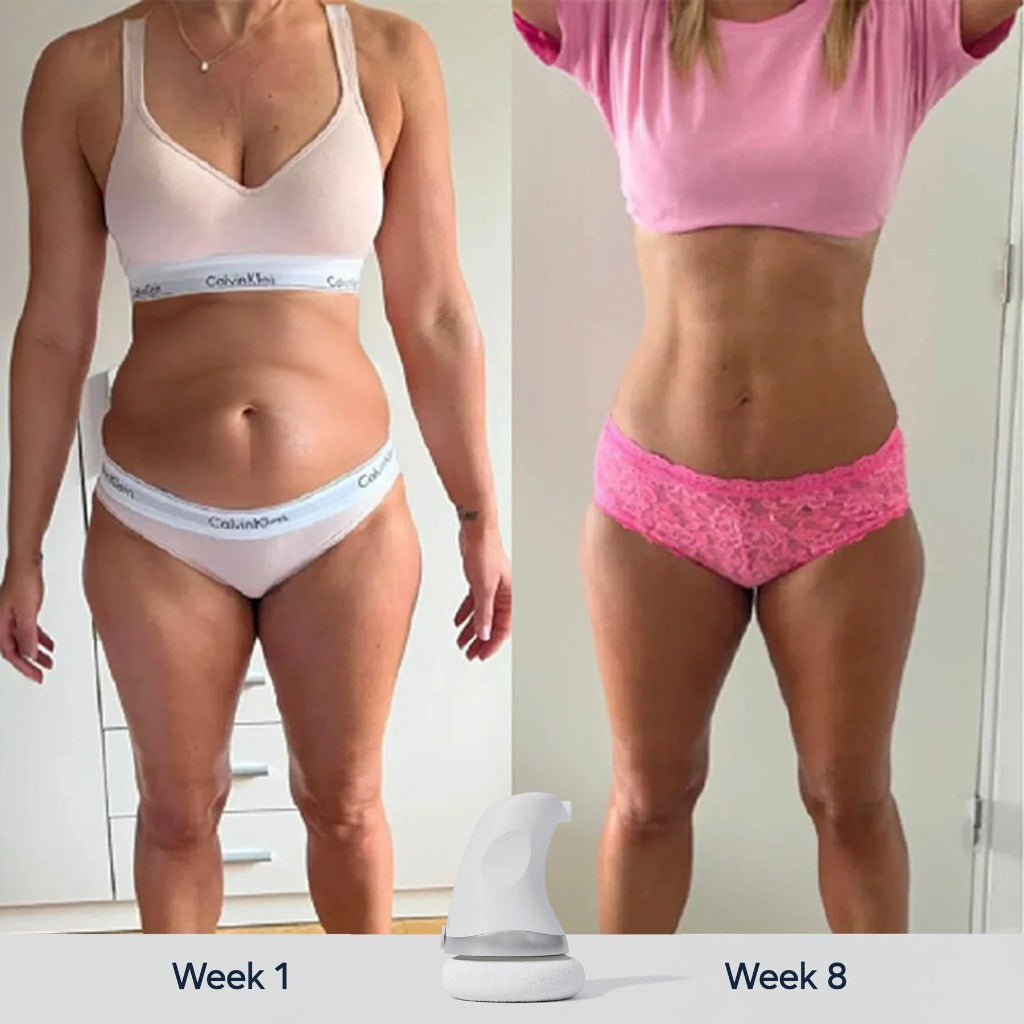 Glowstry BodySculpt before-after
