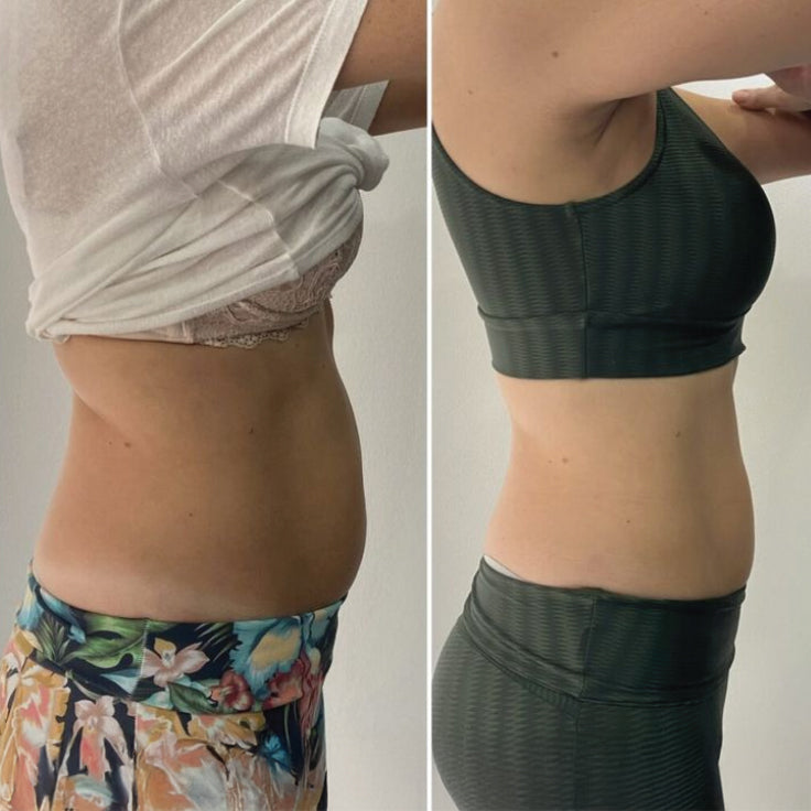 Glowstry BodySculpt before-after review3