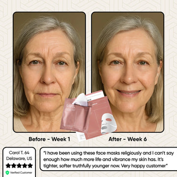 Glowstry Bio-Collagen Mask before-after2