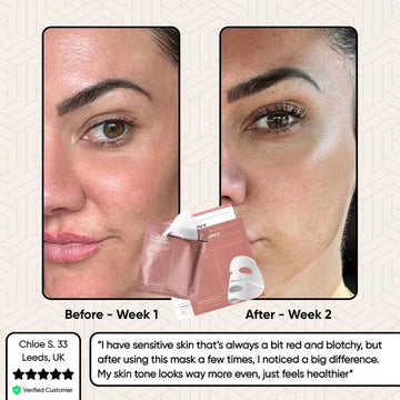 Glowstry Bio-Collagen Mask before-after1