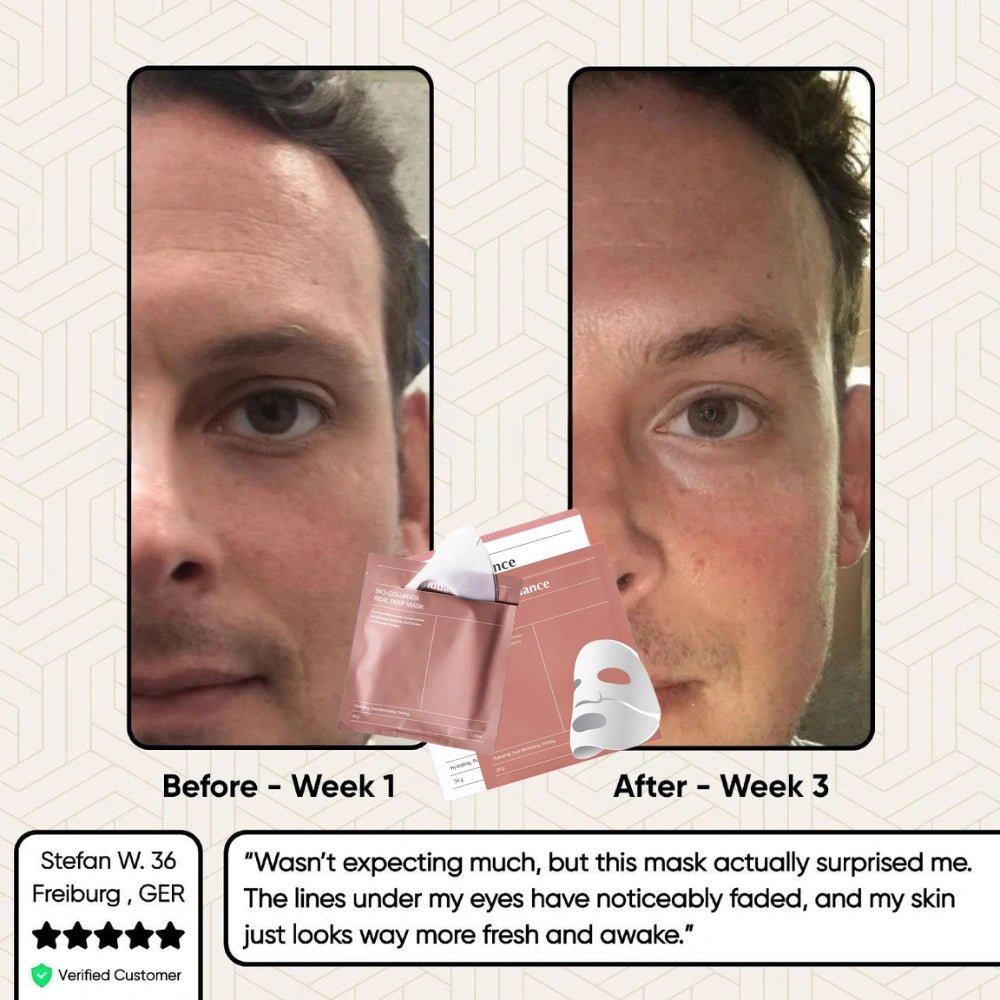 Glowstry Bio-Collagen Mask before-after4