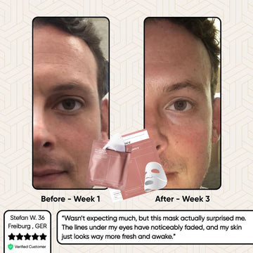 Glowstry Bio-Collagen Mask before-after4